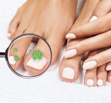 Infección por uñas por unha lupa