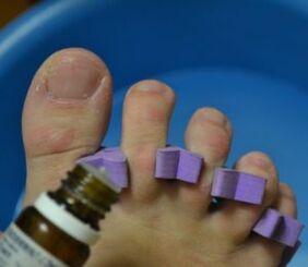 Preparación para tratar unhas con gotas antifúngicas