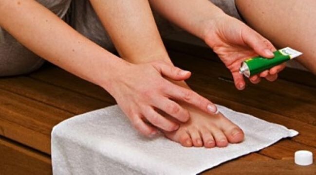Tratar o fungo das unhas dos pés con pomada